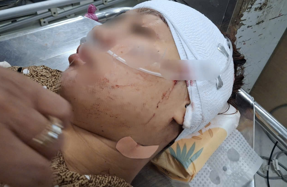 Điều tra nữ cán bộ phường, dùng d/a/o r/ọ/c giấy r/ạc/h mặt “tình địch”