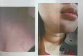 Bị nhóm phụ huynh đánh hội đồng, nữ sinh lớp 12 ở TP.HCM 'kêu cứu'