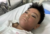 Xót xa cậu bé Mông 10 tuổi bị công nông chèn lên người, khuôn mặt đổi màu đỏ