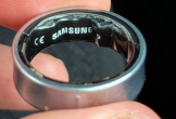 Nhập viện, lỡ chuyến bay vì nhẫn Samsung bị phồng pin