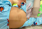 Cháu bé 3 tuổi nghi bị bạo hành tại điểm giữ trẻ tự phát