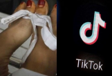 Pakistan: Cô gái 17 tuổi bị cha bắn tử vong vì không chịu xóa tài khoản TikTok