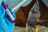 Ngành Y tế Thanh Hóa khuyến cáo về dịch bệnh nguy hiểm do virus Nipah