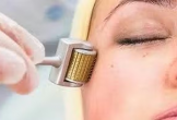Làm đẹp công nghệ cao: Rủi ro tiềm ẩn khi đẹp quá nhanh