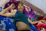 Khốn khó vì mắc bệnh ung thư gan di căn xương