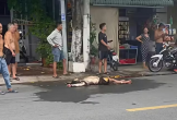 Nam thanh niên bỏng nặng nghi do phóng hỏa tiệm giặt sấy ở Cà Mau